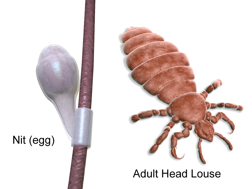 Head lice, Nits